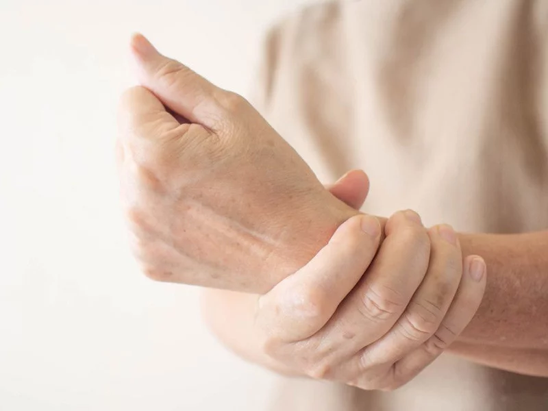 Choroba De Quervaina – zapalenie pochewki ścięgna kciuka