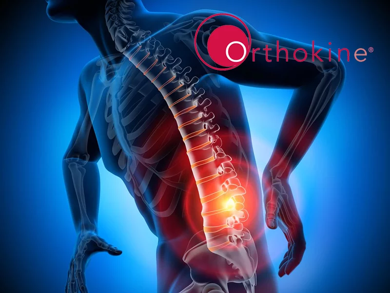 Orthokine